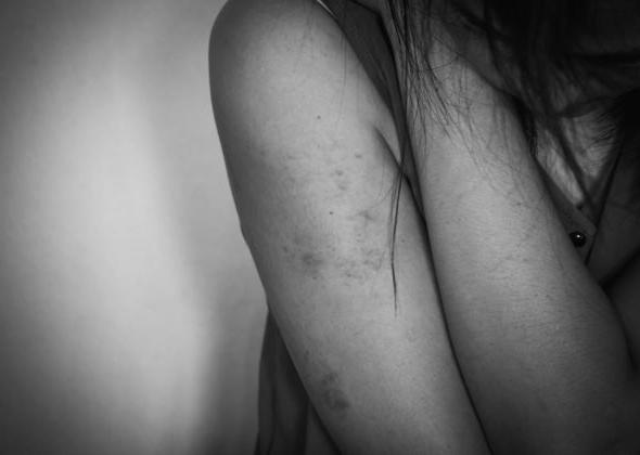 «Είναι οι γυναίκες ζώα;» Η επιστροφή της σεξουαλικής βίας